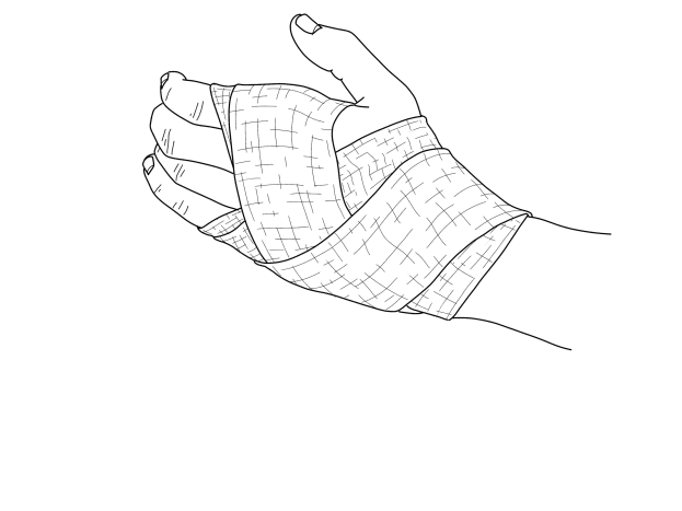 Eine Zeichnung einer Hand mit einer Verband um das Handgelenk gewickelt, die eine Schiene bildet.
